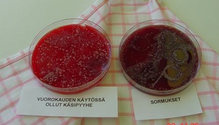 Kaksi petrimaljaa joissa bakteerikasvustot